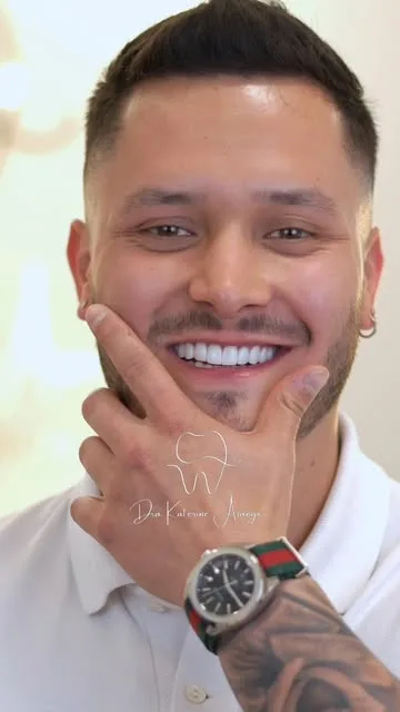 Resultado de diseño de sonrisa