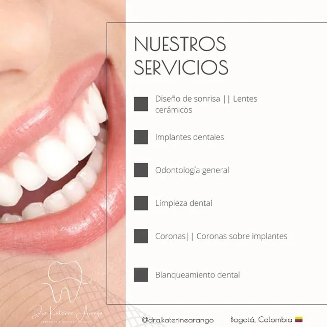 Sonrisa estética — nuestro caso